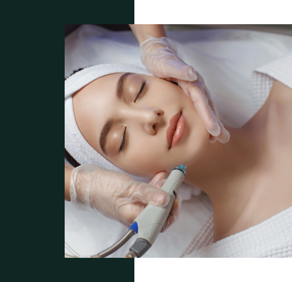 Chemical Peels - Skinfinity Aesthetics  Mississauga's Top Skin & Body  Solutions Clinic